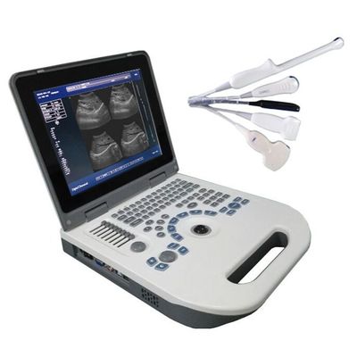 Qualidade  TGC Control Notebook Ultrasound Scanner For Pregnancy Home Use Fábrica
