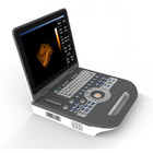 Ecografia portátil de Digitas do equipamento médico do ultrassom de Doppler da cor 4D