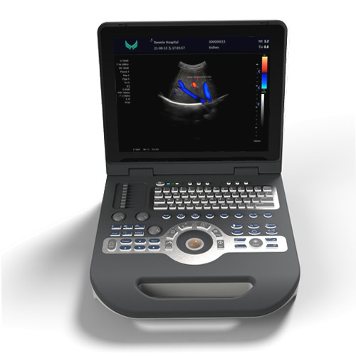 Dispositivo Handheld do ultrassom do varredor 220V Doppler do ultrassom da cor da cardiologia do GV