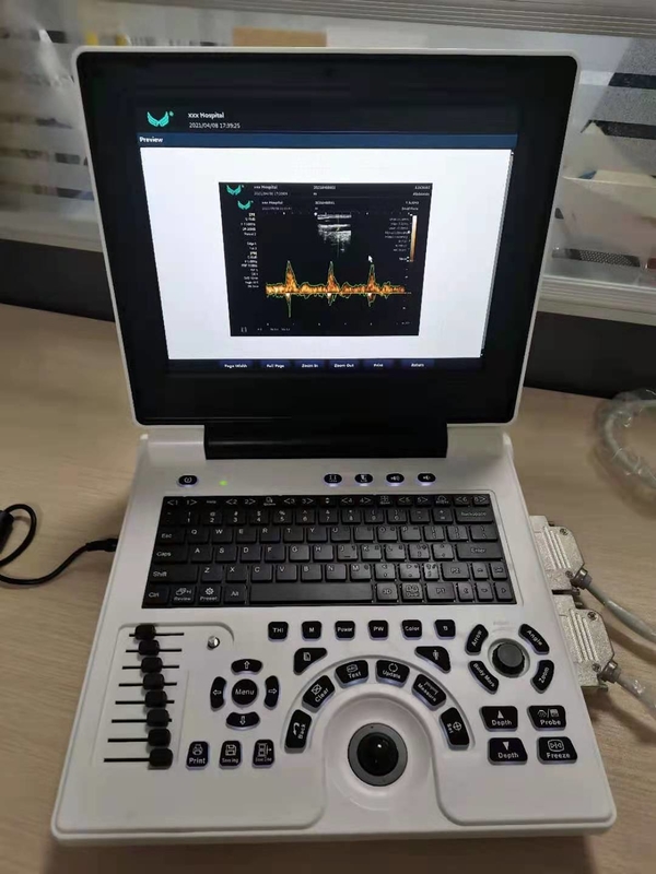 O ultrassom de Doppler da cor da gravidez de Xianfeng faz à máquina o OEM das imagens 4B
