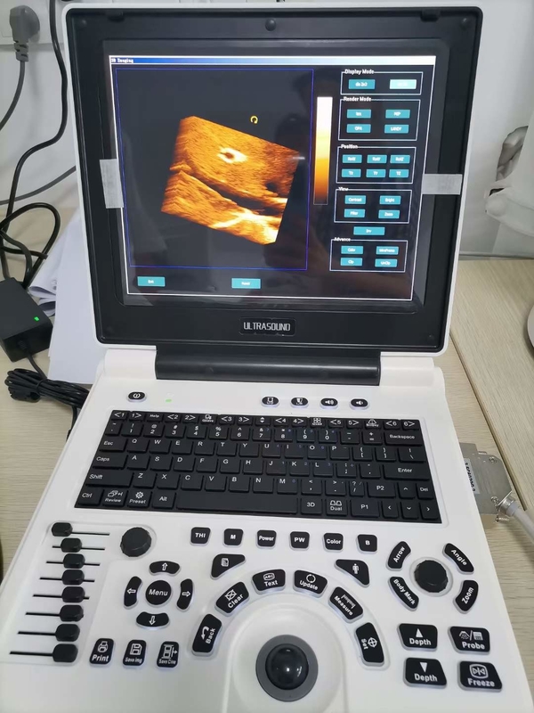 O ultrassom de Doppler da cor da gravidez de Xianfeng faz à máquina o OEM das imagens 4B