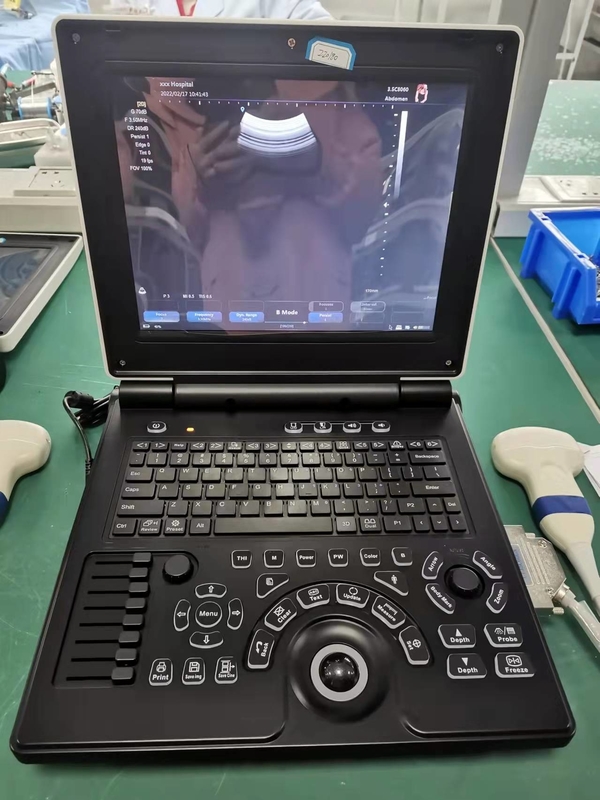 Sistema portátil do ultrassom de Doppler da cor de Digitas da máquina do nível básico USG do ISO