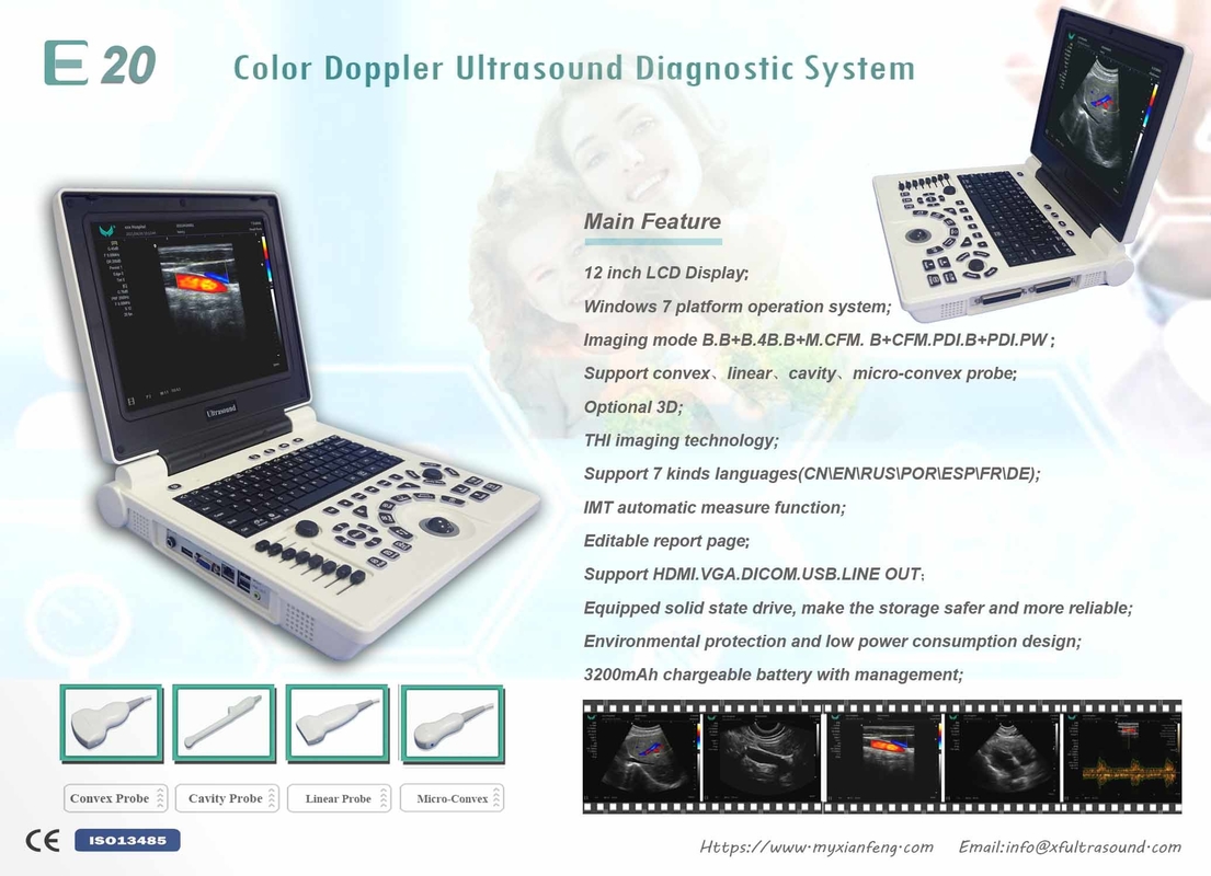 Sistema portátil do ultrassom de Doppler da cor de Digitas da máquina do nível básico USG do ISO