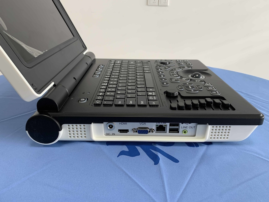 Bateria portátil do varredor 3200mAh do ultrassom de Doppler da cor do sistema Win7