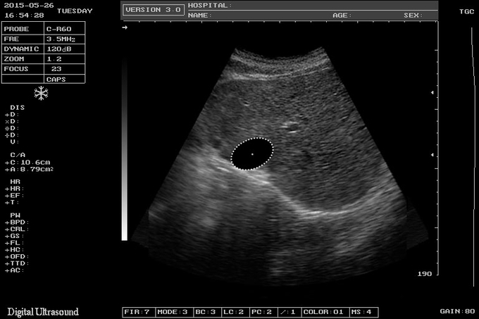 Máquina 64G de SRA Large Animal Veterinary Ultrasound exposição 8 do LCD de 12 polegadas