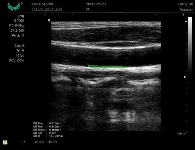 Máquina veterinária portátil do ultrassom 3D do OEM para 6 hospitaleiros clínicos