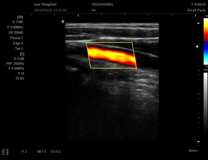 Máquina veterinária portátil do ultrassom 3D do OEM para 5 hospitaleiros clínicos