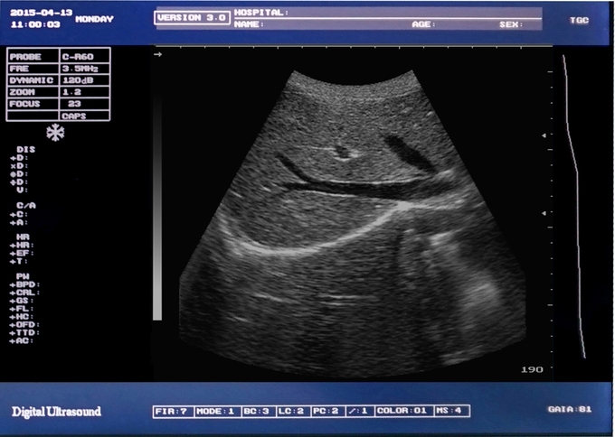 Máquina portátil DRF RDA 6 do ultrassom do veterinário equino de múltiplos propósitos
