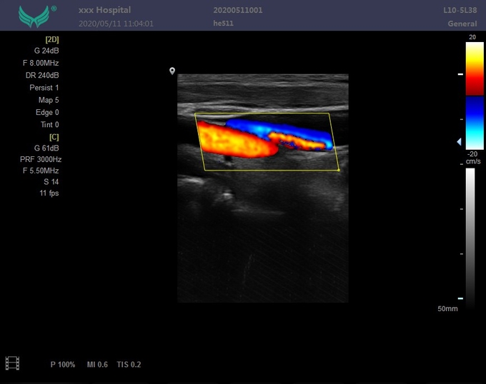 Modo abdominal 7 do picowatt CFM PDI da máquina do ultrassom de Doppler da varredura da classe II