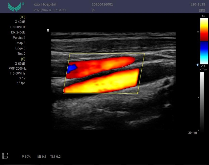 Modo abdominal 6 do picowatt CFM PDI da máquina do ultrassom de Doppler da varredura da classe II