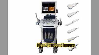 Modo PW CFM PDI do scanner de ultrassom Doppler