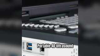 Máquina portátil de ultrassom Doppler 4D pronta para UTI