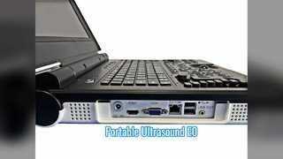 Varredura portátil da urologia do ultrassom Doppler colorido E0