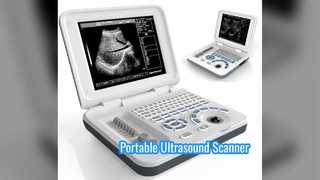 Scanner de ultrassom portátil DRF RDA recarregável